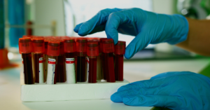 shady abohashem aha cholesterol study
